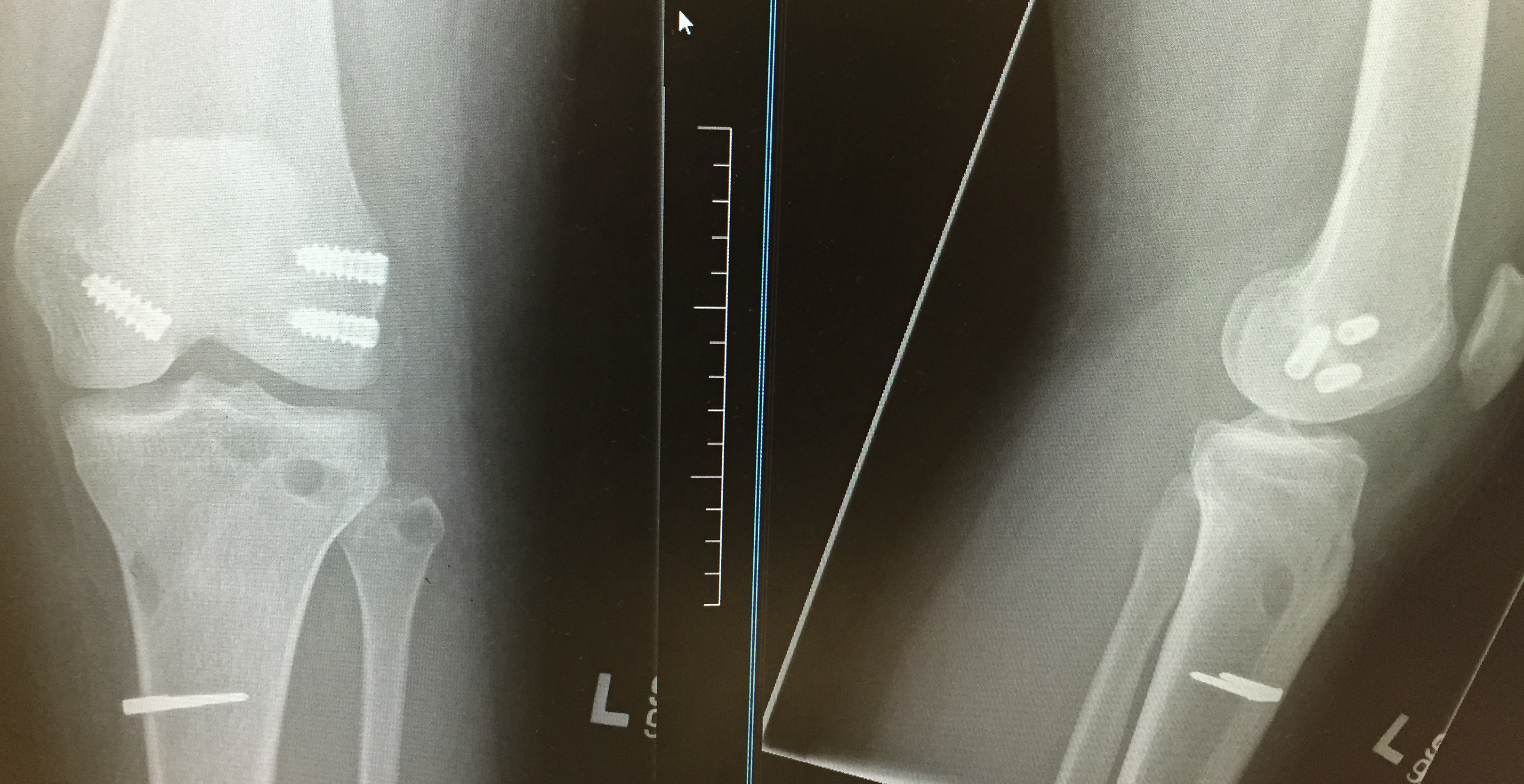 2017-05-24 13.32.25.jpg